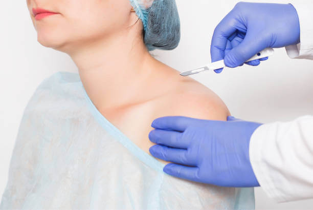 Shoulder Arthroscopy Surgery